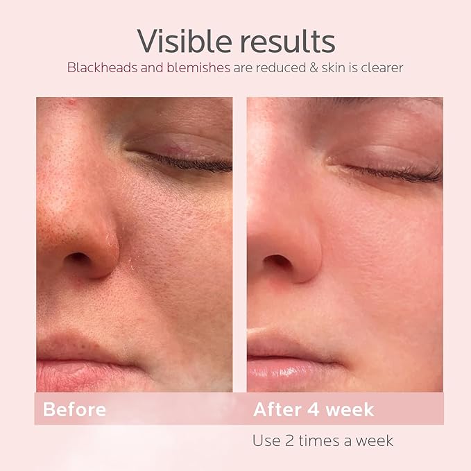 FreshBloom® - Varita de belleza nano iónica