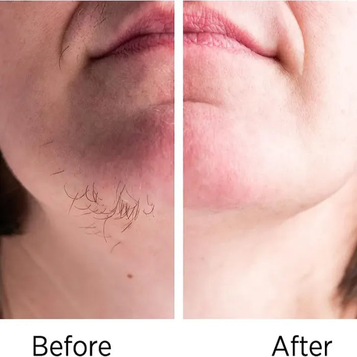 BrowClear - Depilador facial para cejas